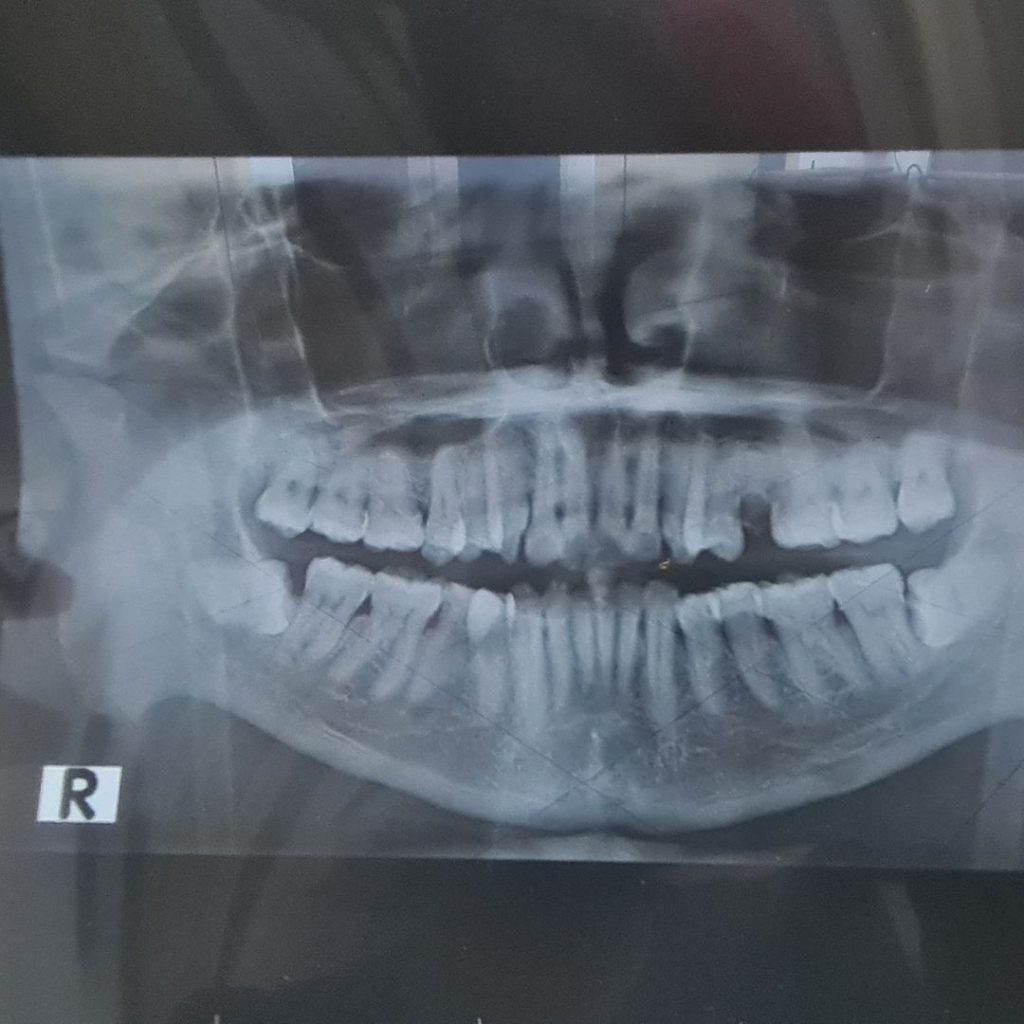 Rontgen gigi terdekat Yuk ketahui mengenai rontgen dental.