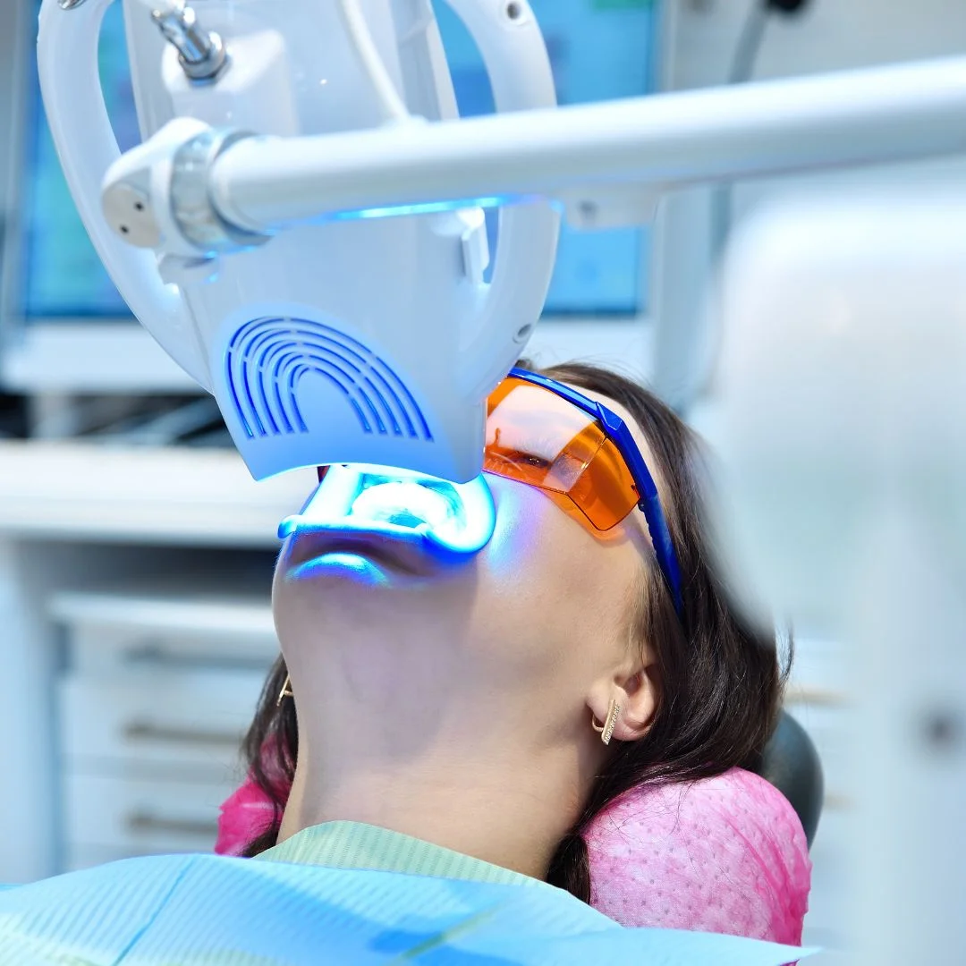 Gigi cerah dan prosedur lebih cepat. Bleaching gigi terdekat di Asha Dental Care